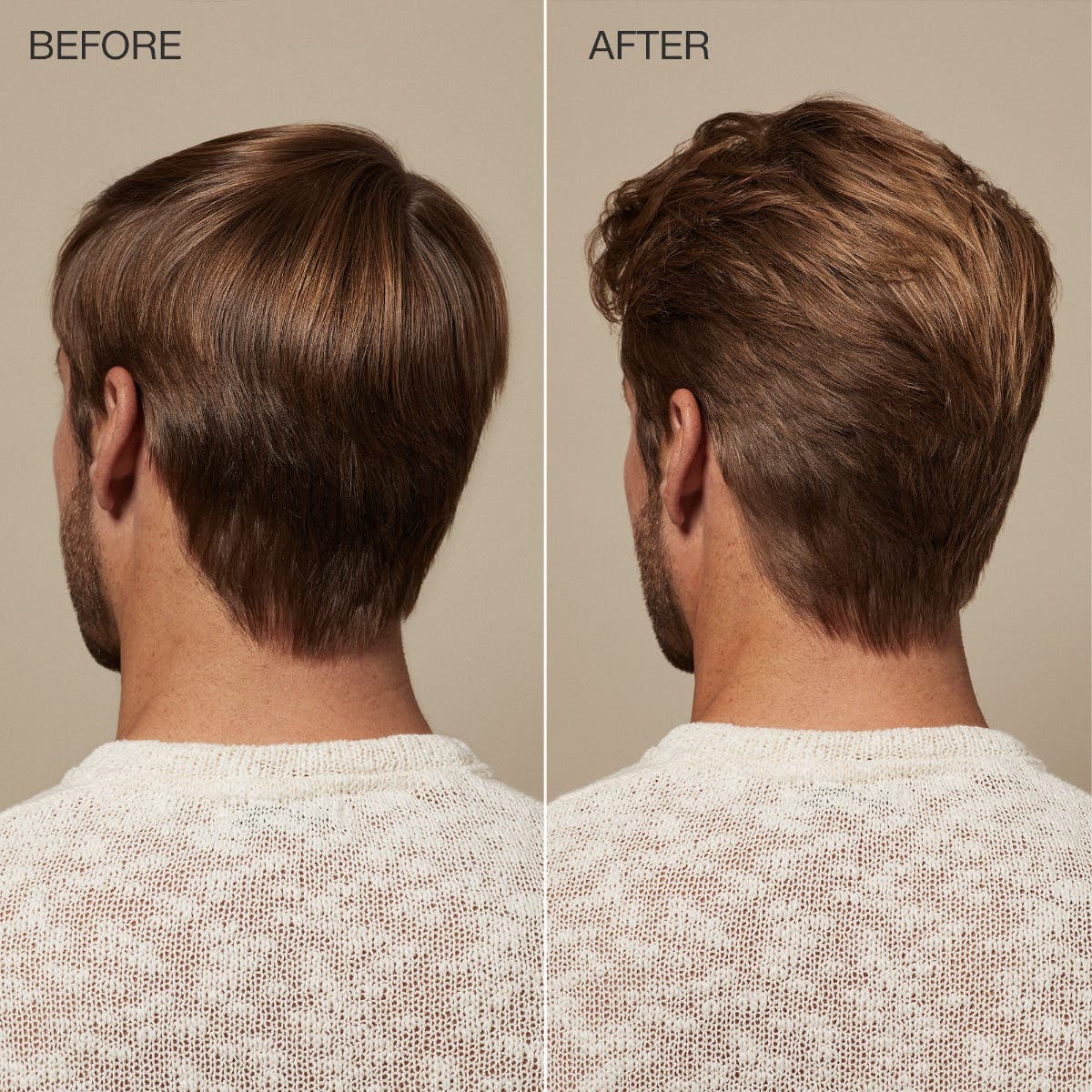 Scalp Care Regeniplex Tonic - Image 4